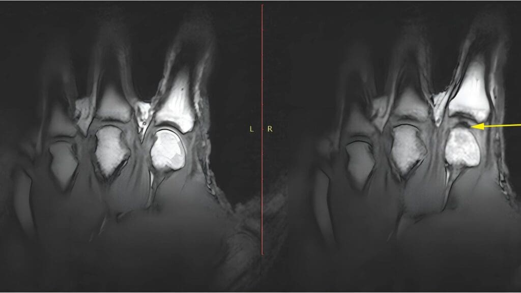 Knuckle Cracking Ruins Joints